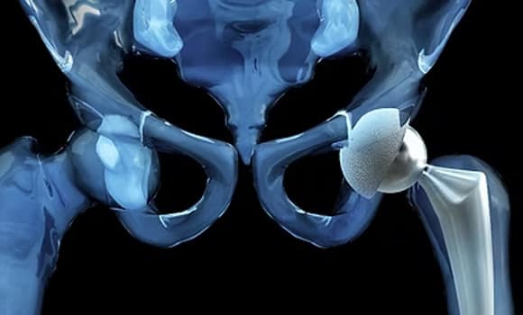 Advanced Titanium Alloy Modelling Expands in QuesTek’s ICMD Platform